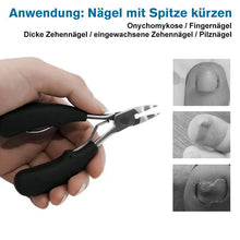 Laden Sie das Bild in den Galerie-Viewer, 304 Edelstahl Nagelknipser-Set, Vorbeugung von Paronychie, Pilzinfektion
